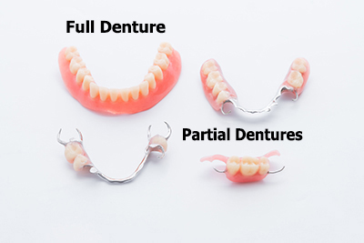 photo of various dentures