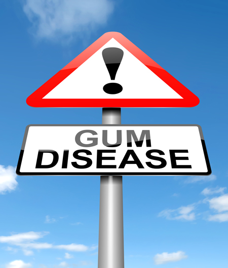 Stock Photo of a sign displaying gum disease