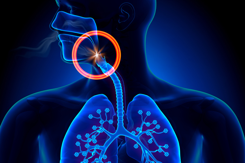 illustration of sleep apnea of throat