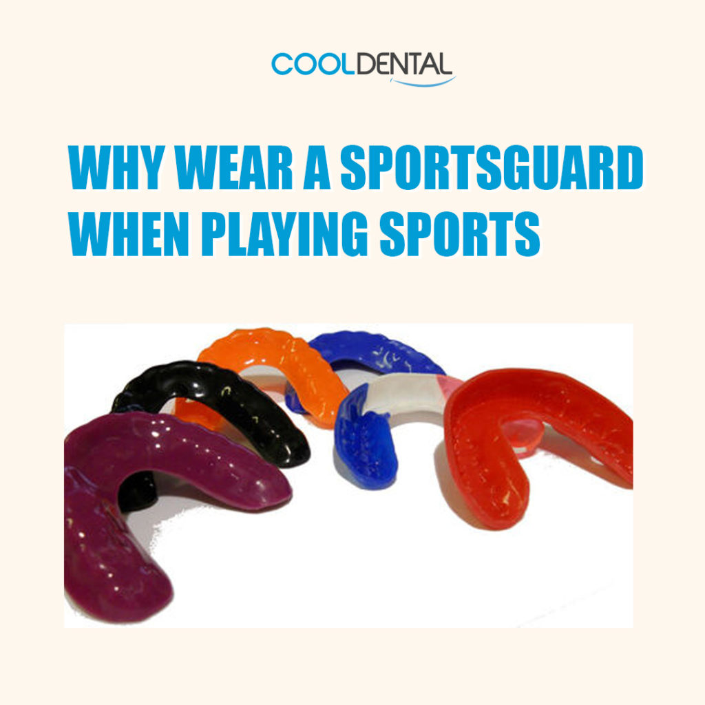 Why wear a sportsguard when playing sports?