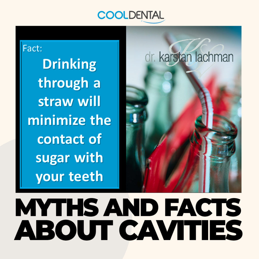 Myths and facts about cavities