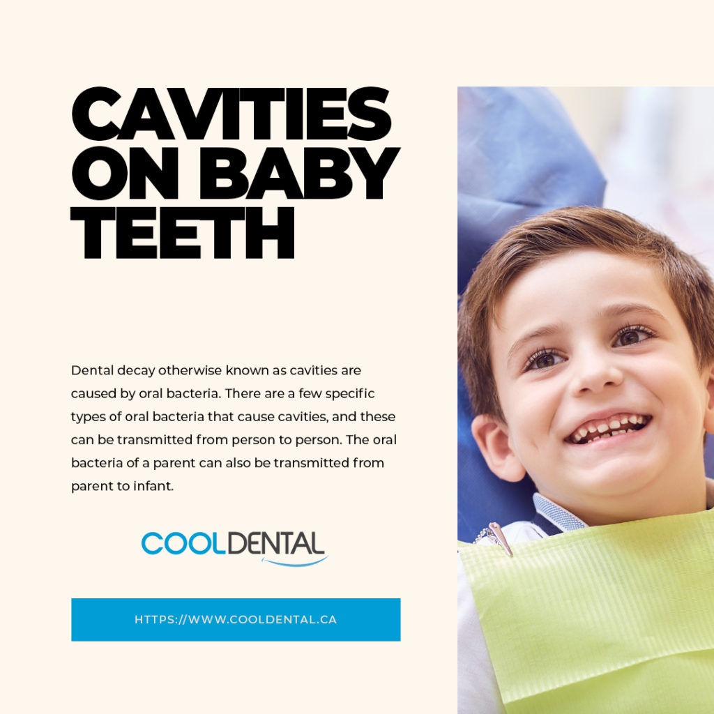 Cavities on baby teeth